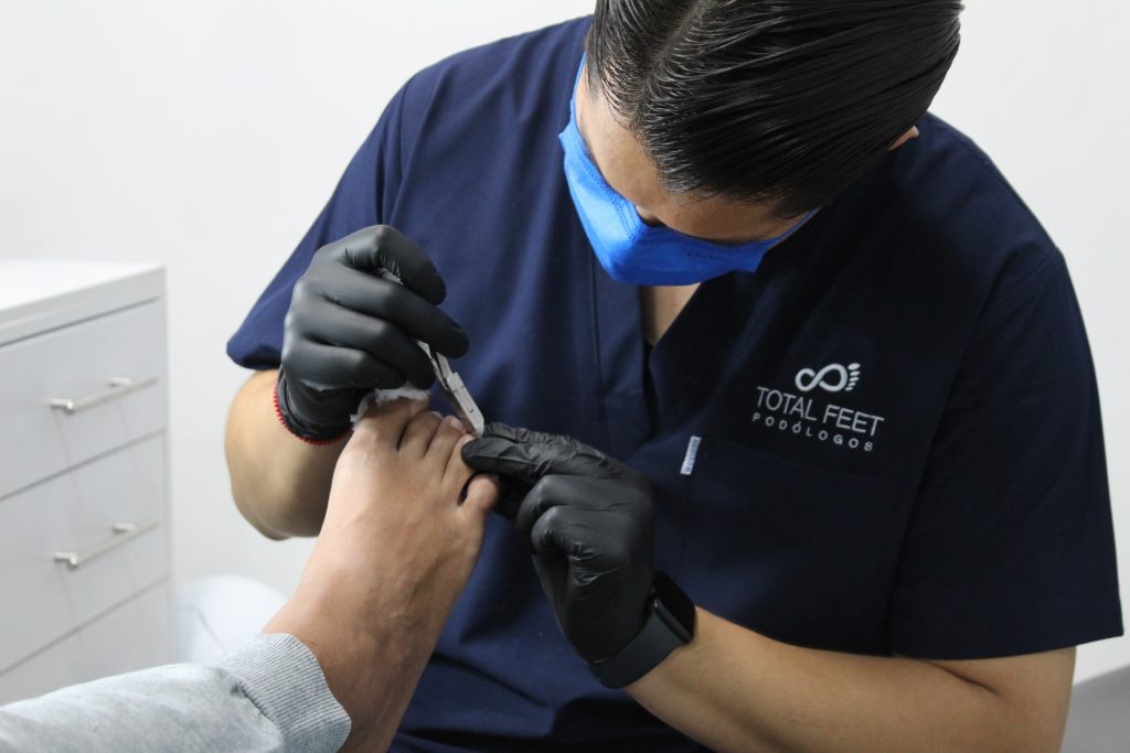un podólogo profesional cortando las uñas de su paciente